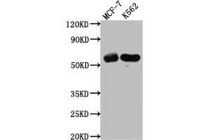 Western Blot Positive WB detected in: MCF-7 whole cell lysate, K562 whole cell lysate All lanes: HDAC2 antibody at 1:1000 Secondary Goat polyclonal to rabbit IgG at 1/50000 dilution Predicted band size: 56, 52 kDa Observed band size: 60 kDa (Recombinant HDAC2 antibody)