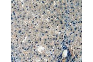 Used in DAB staining on fromalin fixed paraffin- embedded liver tissue (AMBP antibody  (AA 22-203))