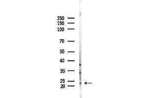 anti-RAB35, Member RAS Oncogene Family (RAB35) (Internal Region) antibody