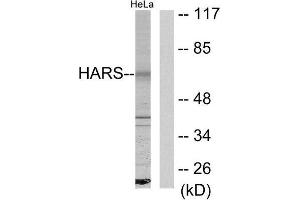 Western Blotting (WB) image for anti-Histidyl-tRNA Synthetase (HARS1) (C-Term) antibody (ABIN1849156) (HARS1/Jo-1 antibody  (C-Term))