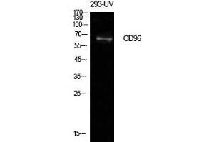 Western Blot (WB) analysis of 293-UV cells using CD96 Polyclonal Antibody. (CD96 antibody  (Internal Region))