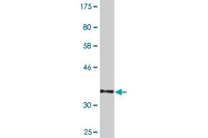 Western Blot detection against Immunogen (36. (NXF3 antibody  (AA 1-100))