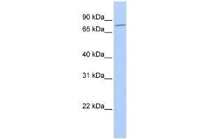 WB Suggested Anti-MZF1 Antibody Titration: 0. (MZF1 antibody  (N-Term))