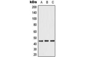 Western blot analysis of Caspase 1 expression in A549 (A), Caco2 (B), THP1 (C) whole cell lysates. (Caspase 1 antibody  (C-Term))