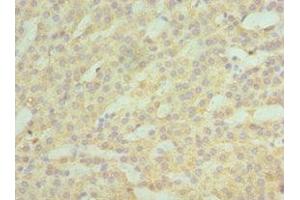 Immunohistochemistry of paraffin-embedded human kidney tissue using ABIN7142987 at dilution of 1:100 (ASAH1 antibody  (AA 146-395))
