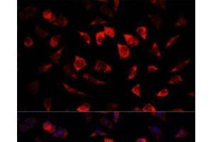 Immunofluorescence analysis of L929 cells using IGFBP4 Polyclonal Antibody at dilution of 1:100. (IGFBP4 antibody)