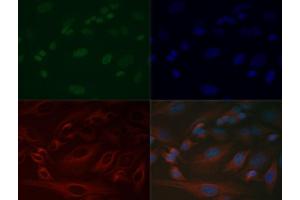 Immunofluorescence of Anti-Histone H3 K37 me1: Histone H3 monomethyl Lys37 antibody was tested at 1:200 in HeLa cells with FITC (green). (Histone 3 antibody  (H3K37me))