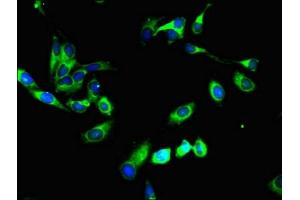 Immunofluorescent analysis of Hela cells using ABIN7151230 at dilution of 1:100 and Alexa Fluor 488-congugated AffiniPure Goat Anti-Rabbit IgG(H+L) (SYVN1 antibody  (AA 338-487))