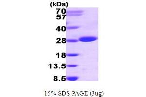 SDS-PAGE (SDS) image for Inosine Triphosphatase (ITPA) (AA 1-194) protein (His tag) (ABIN667158)