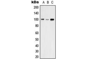 Western blot analysis of VAV2 expression in A431 (A), THP1 (B), NIH3T3 (C) whole cell lysates.