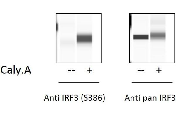 IRF3 ELISA Kit