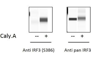 HT29 cells were treated or untreated with  Calyculin A and analyzed using this phosphoELISA and Western Blot. (IRF3 ELISA Kit)