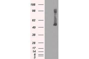 Image no. 2 for anti-Glucokinase (Hexokinase 4) (GCK) antibody (ABIN1498413) (GCK antibody)