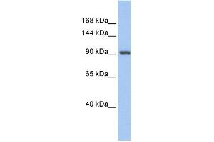 WB Suggested Anti-ZNF295 Antibody Titration:  0. (ZNF295 antibody  (N-Term))