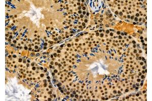 NUCL Antibody at 1/100 staining Mouse lung tissue by IHC-P.