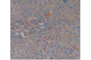 IHC-P analysis of Rat Liver Tissue, with DAB staining. (Complement Factor H antibody  (AA 975-1217))