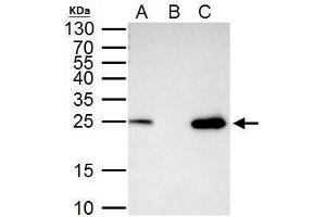 IP Image mtTFA antibody immunoprecipitates mtTFA protein in IP experiments. (TFAM antibody)