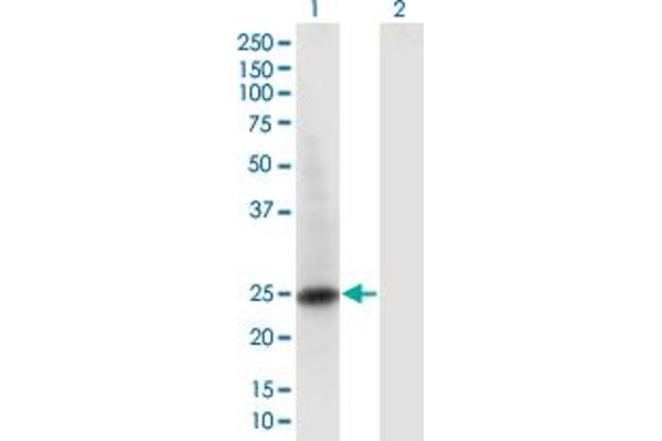 RAB6B antibody  (AA 1-208)