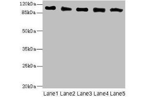 Western blot All lanes: COPB2 antibody at 2.