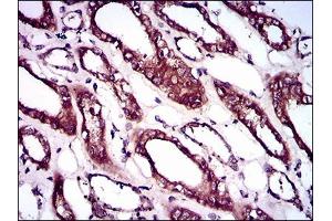 Immunohistochemical analysis of paraffin-embedded kidney tissues using BMPR1A mouse mAb with DAB staining.