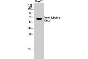 Western Blotting (WB) image for anti-alpha Tubulin (TUBA1) (acLys112) antibody (ABIN6285448)