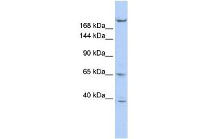 WB Suggested Anti-KIF13B Antibody Titration:  1 ug/ml  Positive Control:  HepG2 cell lysate KIF13B is supported by BioGPS gene expression data to be expressed in HepG2