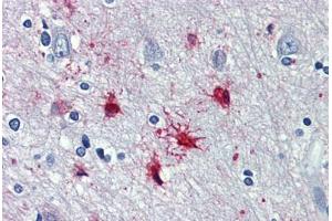 Human Brain, cortex: Formalin-Fixed, Paraffin-Embedded (FFPE) (alpha 1 Adrenergic Receptor antibody  (AA 206-270))