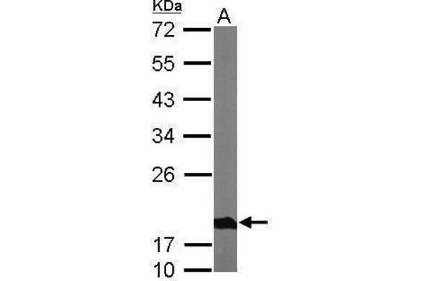 NDUFS4 antibody  (Center)