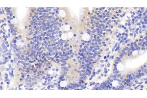 Detection of DTYMK in Human Small intestine Tissue using Polyclonal Antibody to Deoxythymidylate Kinase (DTYMK) (DTYMK antibody  (AA 43-190))
