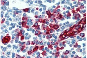 Human Tonsil: Formalin-Fixed, Paraffin-Embedded (FFPE) (SELPLG antibody)