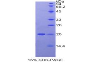 SDS-PAGE analysis of Human Tafazzin Protein.