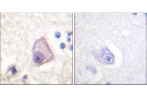 Immunohistochemistry analysis of paraffin-embedded human brain, using SEK1/MKK4/JNKK1 (Phospho-Ser257) Antibody. (MAP2K4 antibody  (pSer257))