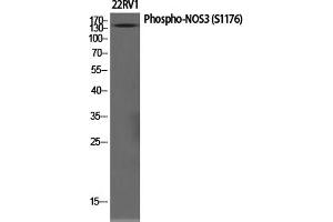 Western Blotting (WB) image for anti-Nitric Oxide Synthase 3 (Endothelial Cell) (NOS3) (pSer1177) antibody (ABIN5961402) (ENOS antibody  (pSer1177))
