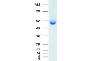 Validation with Western Blot (ALDH1A1 Protein (Myc-DYKDDDDK Tag))