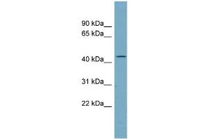 WB Suggested Anti-AADACL4 Antibody Titration:  0. (AADACL4 antibody  (N-Term))
