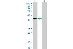 Western Blot analysis of MVK expression in transfected 293T cell line by MVK MaxPab polyclonal antibody.