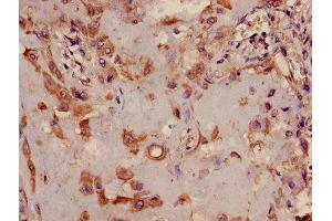 Immunohistochemistry of paraffin-embedded human placenta tissue using ABIN7173361 at dilution of 1:100 (TRIB2 antibody  (AA 204-337))