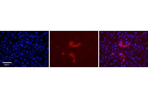 Rabbit Anti-RPS28 Antibody  Catalog Number: ARP65601_P050 Formalin Fixed Paraffin Embedded Tissue: Human Adult Liver  Observed Staining: Cytoplasm in Kupffer cells only, strong signal, very low tissue distribution Primary Antibody Concentration: 1:100 Secondary Antibody: Donkey anti-Rabbit-Cy3 Secondary Antibody Concentration: 1:200 Magnification: 20X Exposure Time: 0. (RPS28 antibody  (N-Term))