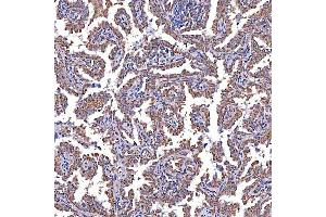 IHC analysis of TRMT2B using anti-TRMT2B antibody (ABIN7599456). (TRMT2B antibody  (AA 1-504))