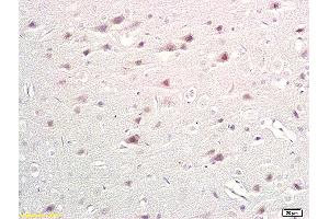 Formalin-fixed and paraffin embedded rat brain labeled with Anti-TPH/Trptophan Hydroxylase Polyclonal Antibody, Unconjugated (ABIN673509) at 1:200 followed by conjugation to the secondary antibody and DAB staining. (Trptophan Hydroxylase (AA 31-150) antibody)