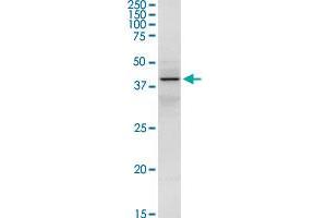 SERPINA3 MaxPab rabbit polyclonal antibody. (SERPINA3 antibody  (AA 1-423))