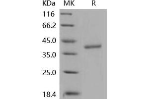Western Blotting (WB) image for Cathepsin Z (CTSZ) (Active) protein (His tag) (ABIN7194694) (Cathepsin Z Protein (CTSZ) (His tag))