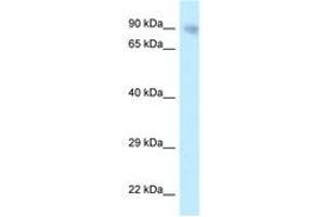 Image no. 1 for anti-Protein Phosphatase 6, Regulatory Subunit 3 (PPP6R3) (AA 201-250) antibody (ABIN6747776) (PPP6R3 antibody  (AA 201-250))