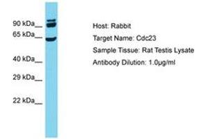 Image no. 1 for anti-Cell Division Cycle 23 (CDC23) (AA 119-168) antibody (ABIN6750414) (CDC23 antibody  (AA 119-168))