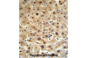 Immunohistochemistry (IHC) image for anti-Hemopexin (HPX) antibody (ABIN3002733) (Hemopexin antibody)