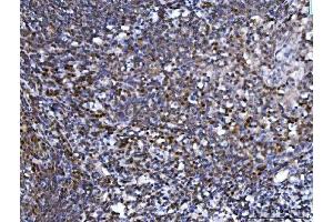 IHC analysis of SPT5/SUPT5H using anti-SPT5/SUPT5H antibody (ABIN7601985). (SUPT5H antibody  (AA 533-1087))