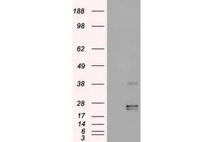 HEK293T cells were transfected with the pCMV6-ENTRY control (Left lane) or pCMV6-ENTRY OSM (Right lane) cDNA for 48 hrs and lysed. (Oncostatin M antibody  (AA 25-252))