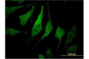 Immunofluorescence of monoclonal antibody to MTMR14 on HeLa cell.
