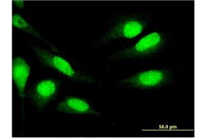 Immunofluorescence of monoclonal antibody to MNDA on HeLa cell.