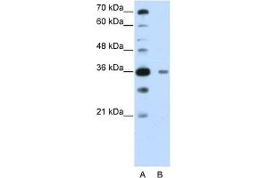 WB Suggested Anti-DAZAP1 Antibody Titration:  0. (DAZAP1 antibody  (C-Term))